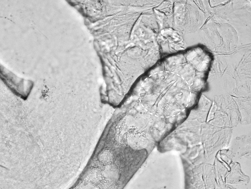 Fisabio participates in the first complete study of the DNA of the Demodex folliculorum mite, the only animal that lives in symbiosis with the human body